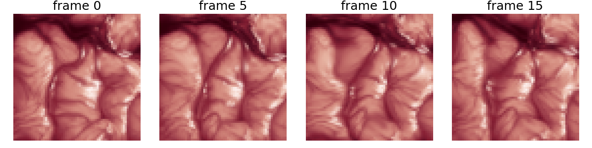 frame 0, frame 5, frame 10, frame 15