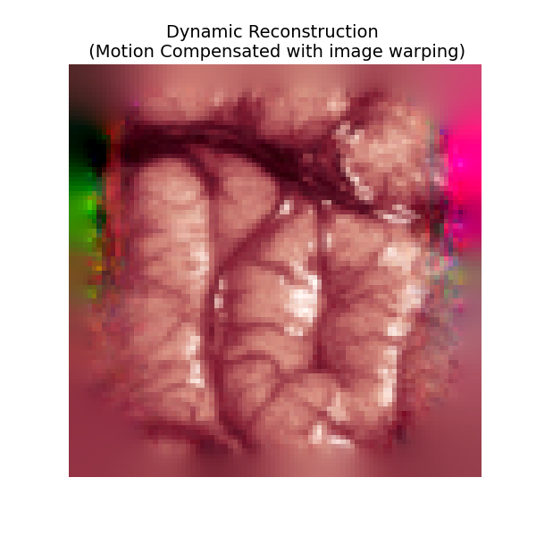 Dynamic Reconstruction   (Motion Compensated with image warping)