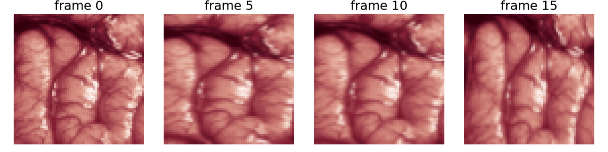 frame 0, frame 5, frame 10, frame 15