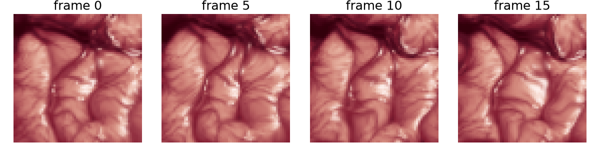 frame 0, frame 5, frame 10, frame 15