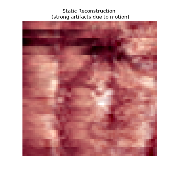 Static Reconstruction (strong artifacts due to motion)