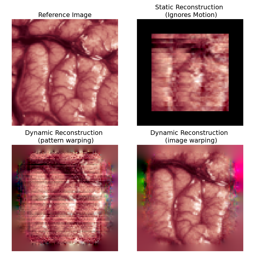 Reference Image, Static Reconstruction (Ignores Motion), Dynamic Reconstruction (pattern warping), Dynamic Reconstruction (image warping)