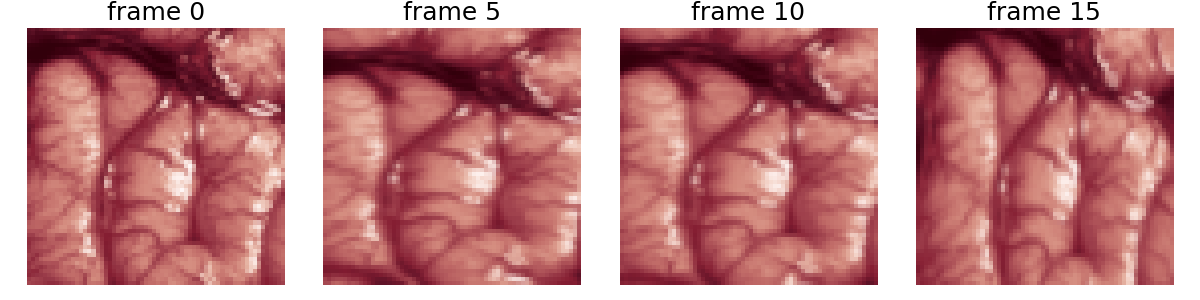frame 0, frame 5, frame 10, frame 15