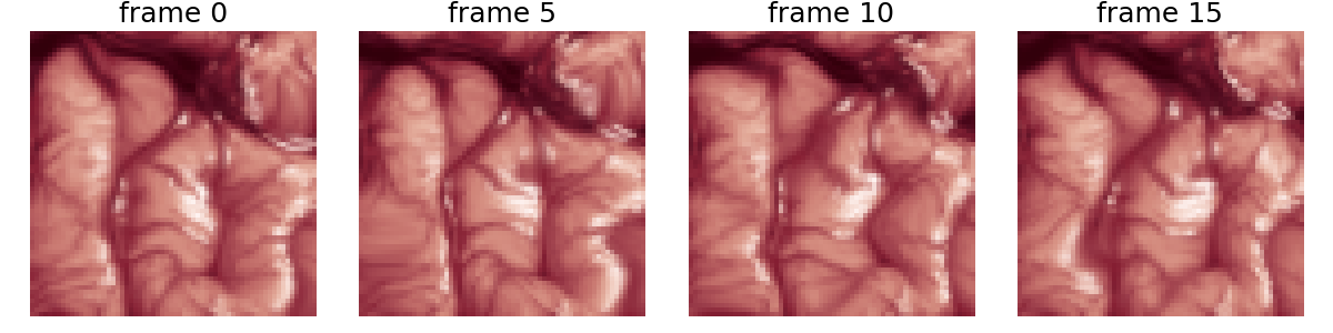 frame 0, frame 5, frame 10, frame 15