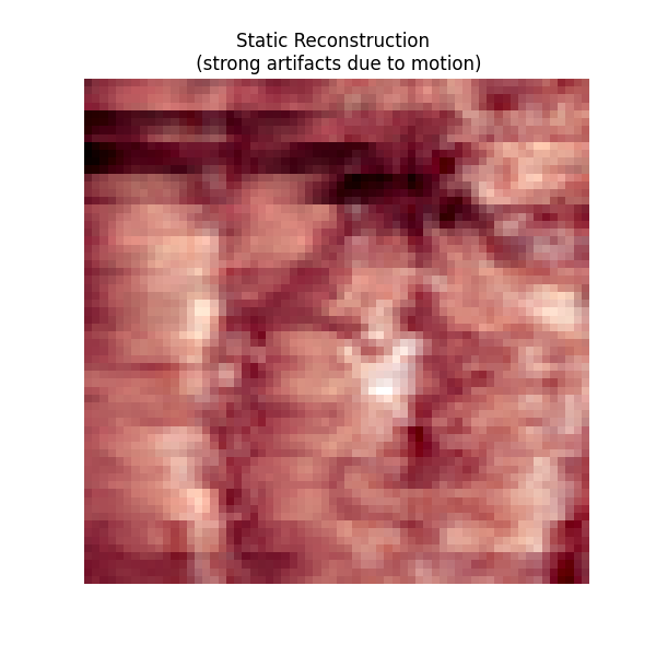 Static Reconstruction   (strong artifacts due to motion)
