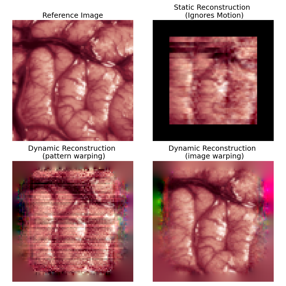 Reference Image, Static Reconstruction   (Ignores Motion), Dynamic Reconstruction   (pattern warping), Dynamic Reconstruction   (image warping)